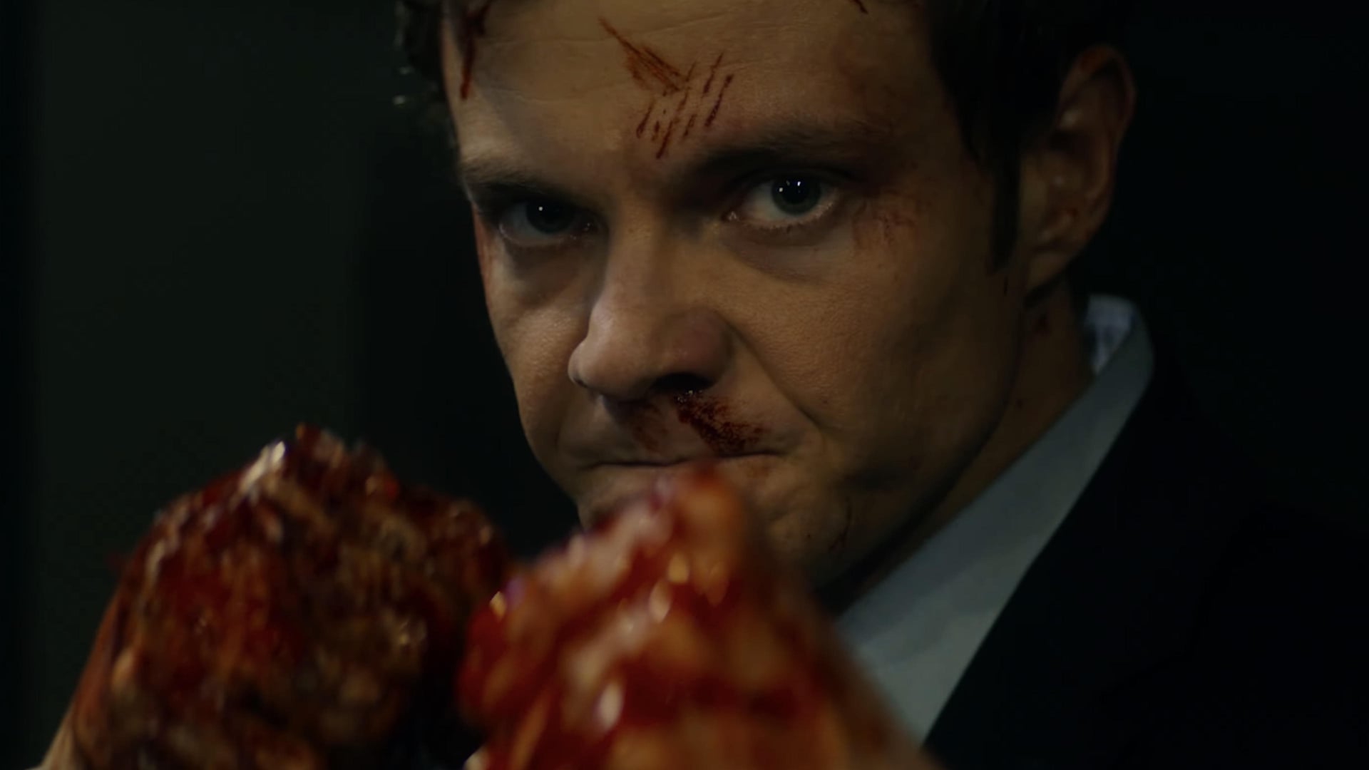 Foto do filme Novocaine: À Prova de Dor