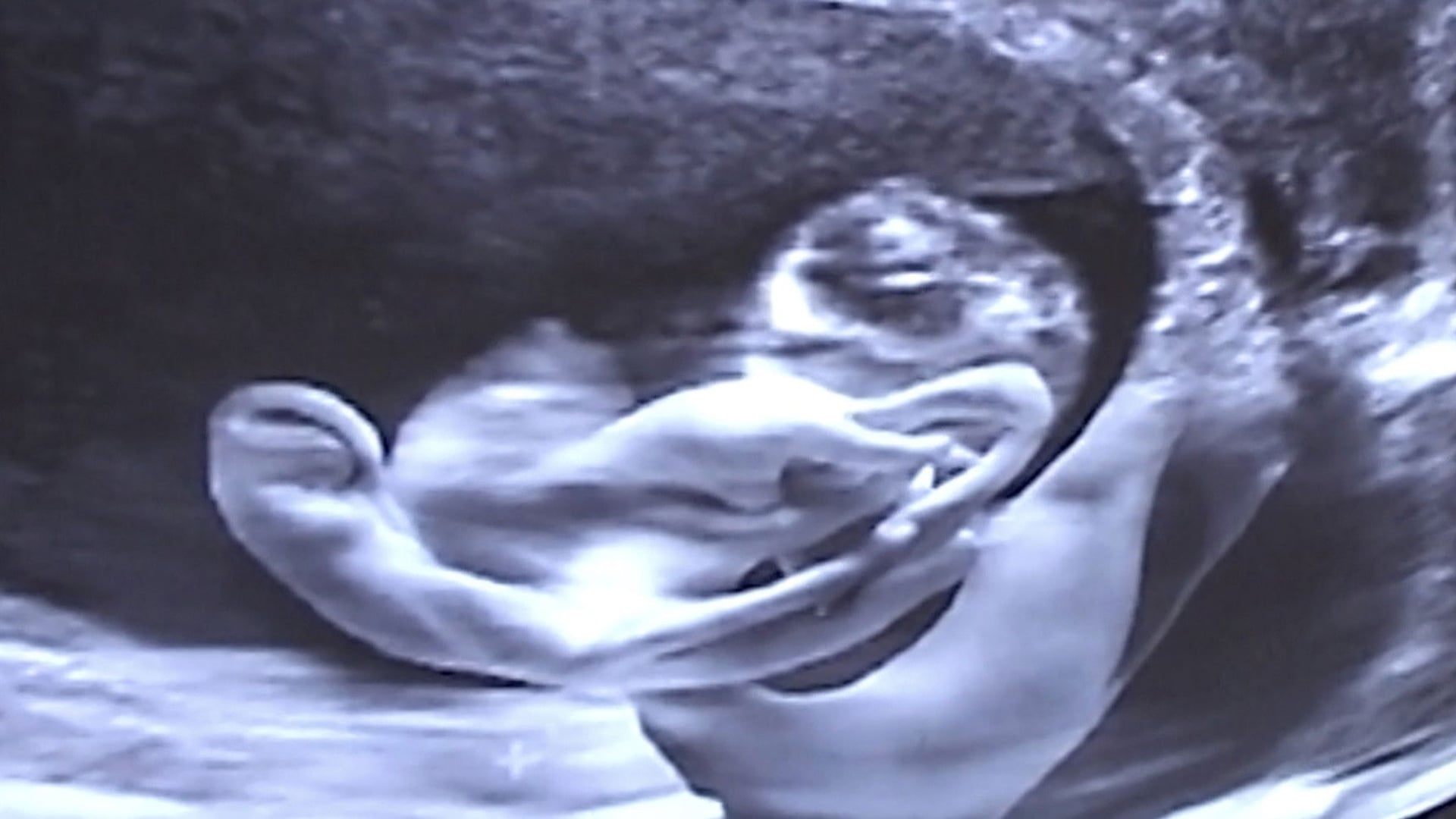 Foto do filme Castration Movie Anthology iii. Year of the Hyaena