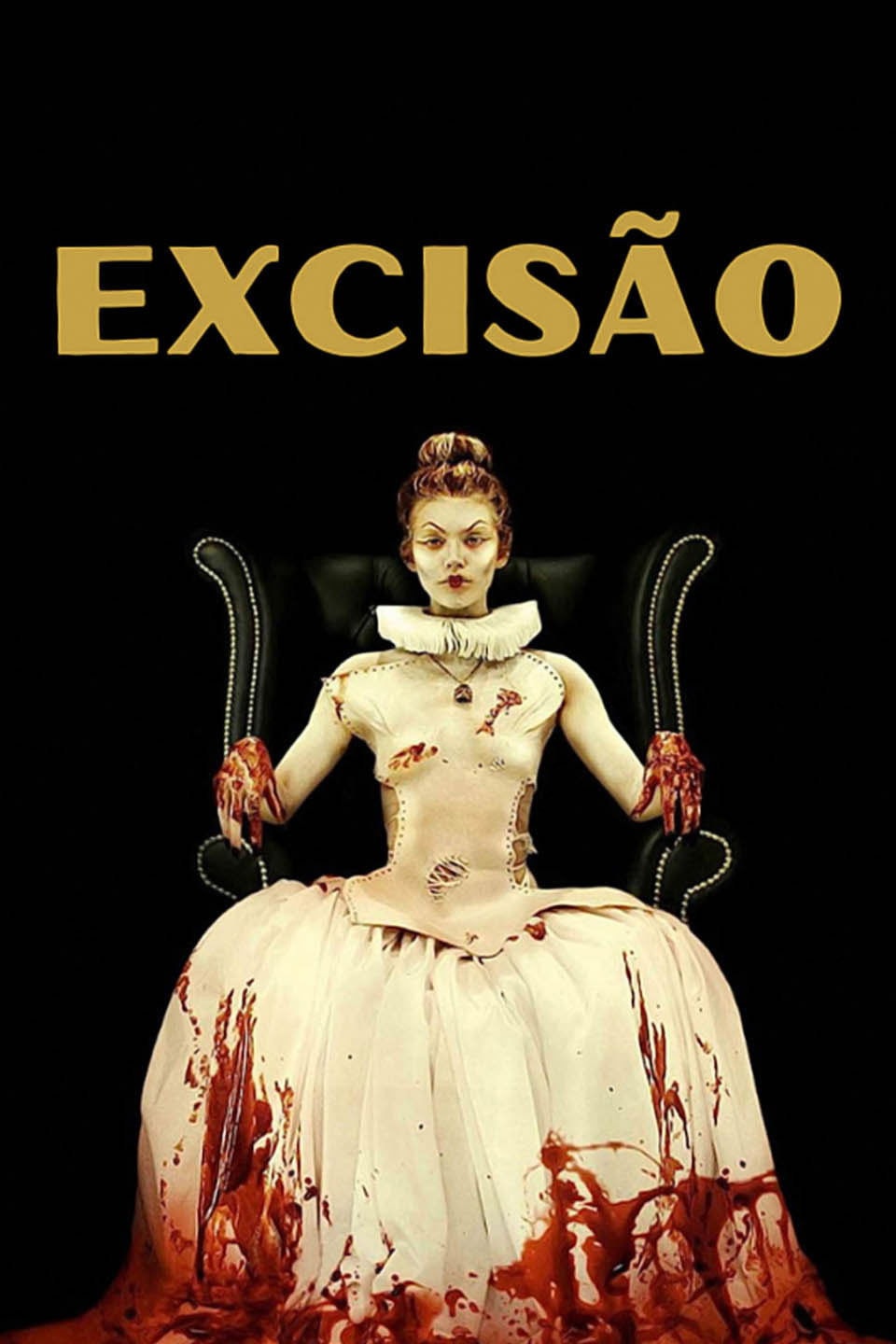 Excision