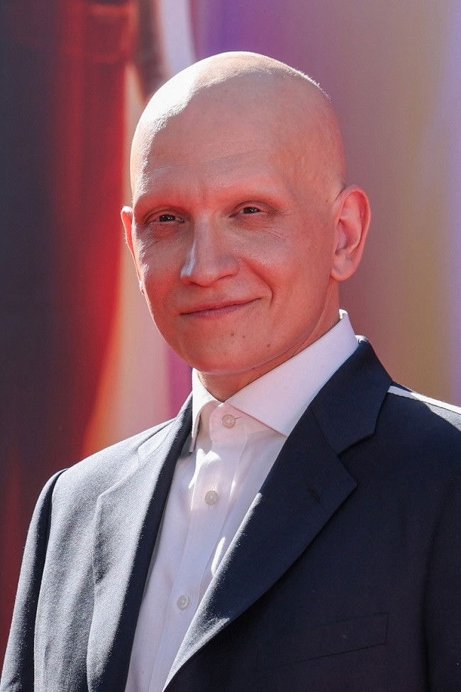Foto de Anthony Carrigan