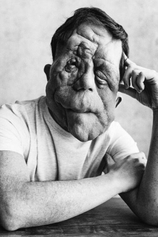 Foto de Adam Pearson