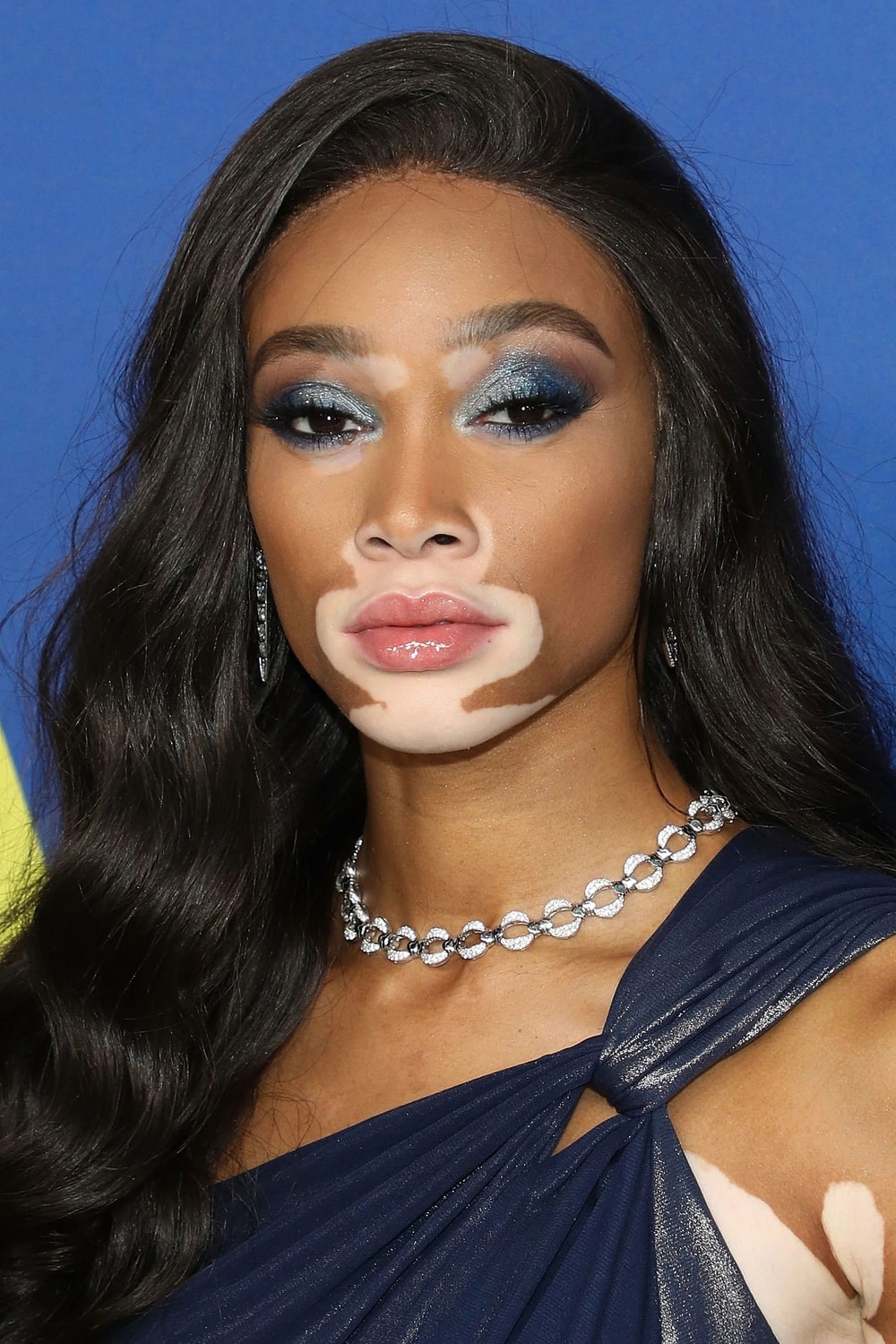 Foto de Winnie Harlow