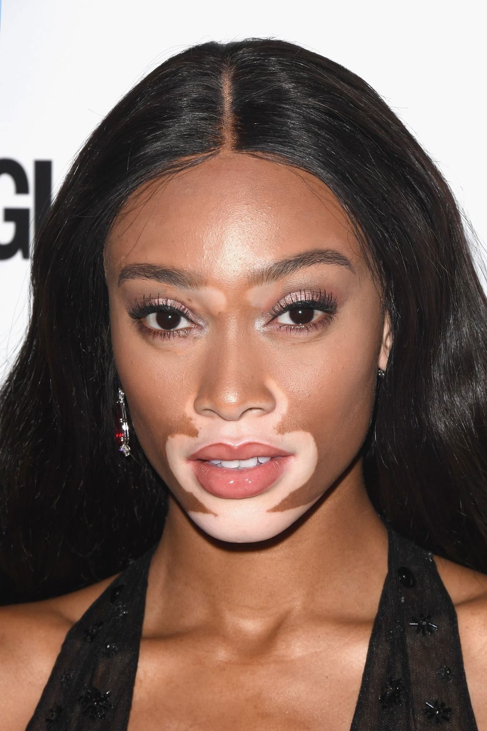 Foto de Winnie Harlow